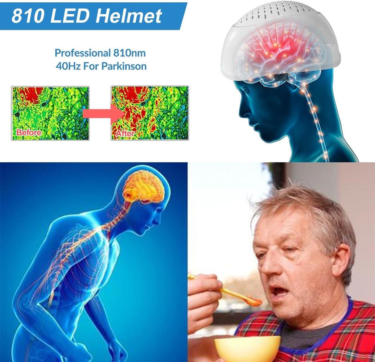Alt view image 6 of 7 - ZJZK 810Nm Helmet For Brain Infarction Treatment 1-20000Hz Led Infrared Light Therapy For Cerebral Thrombosis Dementia