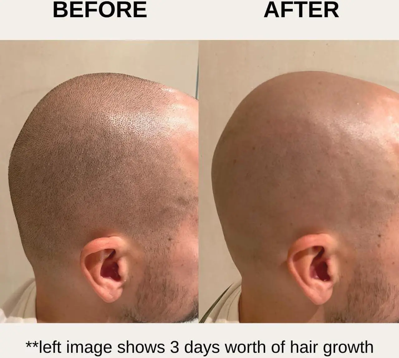 Alt view image 6 of 7 - The Bald Express Electric Head Shavers for Bald Men - The Bald Brothers - 5 in 1 Mens Cordless Grooming Kit | Electric Shaving for Bald Men | USB Charge | Skull Shaver for Men
