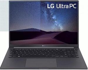 LG Ultra PC U 16U70R-N.APC7U1 16" Notebook - WUXGA - 1920 x 1200 - AMD Ryzen 7 7730U Octa-core (8 Core) 2 GHz - 16 GB Total RAM - 16 GB On-board Memory - 1 TB SSD - Charcoal Gray - AMD Chip - Win
