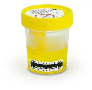 GLOBE SCIENTIFIC 3856TP TransferTop Urine Collection Cup w/Integrated Transfer