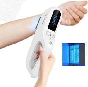 Kernel KN-5000F high power portable 308 nm Excimer laser for vitiligo psoriasist skin disorders targeted treatment