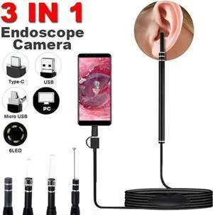 Aomoproing 1Set In Ear Cleaning Endoscope Usb Visual Ear Spoon 5.5Mm Mini Camera Android Pc Ear Pick Otoscope Borescope Tool Health Care