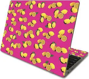 MightySkins Skin Compatible With Samsung Chromebook 4 (2021) 11.6" - Make Lemonade | Protective, Durable, and Unique Vinyl Decal wrap cover | Easy To Apply, Remove, and Change Styles | Made in the USA