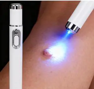 Blue light pens are very effective for people with moles on their skin who need to improve their skin quality. Blue light pens are very effective for people with moles on their skin who need to improve their skin quality.
