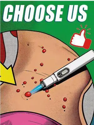 Blue Light Pen Solve moles, Hot Sale Wart Care Tools Blue Light Pen Solve moles, Hot Sale Wart Care Tools