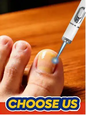 2026 Must-Have Foot Blue Light Laser Pen, Non-Irritating Mild for Home Daily Use 2026 Must-Have Foot Blue Light Laser Pen, Non-Irritating Mild for Home Daily Use
