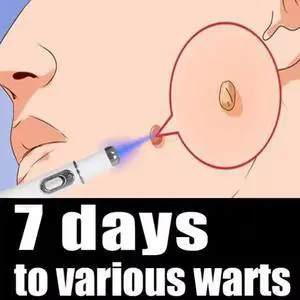 Blue light Pen Skin Tag Remover, Mole Wart Dark Spot Freckle Nevus Blemish Pimple Removal for Face & Body Blue light Pen Skin Tag Remover, Mole Wart Dark Spot Freckle Nevus Blemish Pimple Removal for Face & Body