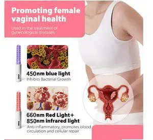 COZING-W06 Cold Laser Therapy Physiotherapy Device Female Vaginitis Treatment Instrument Female Vaginitis Treatment Instrument COZING-W06 Cold Laser Therapy Physiotherapy Device Female Vaginitis Treatment Instrument Female Vaginitis Treatment Instrument