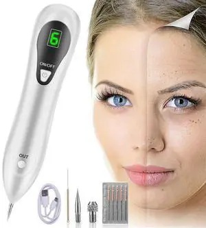 Electric Laser Plasma Pen Mole Removal Dark Spot Remover Skin Wart Tag Tattoo Electric Laser Plasma Pen Mole Removal Dark Spot Remover Skin Wart Tag Tattoo