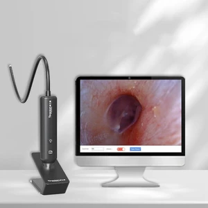 GANGXUN Smart Otoscope, Digital Otology Inspection Camera 1280x720, USB Ear Scope with LED for Hearing Aid Fitting, Windows & Mac GANGXUN Smart Otoscope, Digital Otology Inspection Camera 1280x720, USB Ear Scope with LED for Hearing Aid Fitting, Windows & Mac