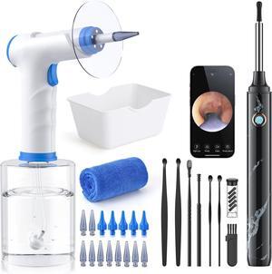 Electric Ear Irrigation Kit with 4 Pressure Modes, Ear Cleaner with Camera, 1080P Otoscope, Ear Cleaning Tool with 7-Piece Set, Earwax Removal Kit for Daily Cleaning