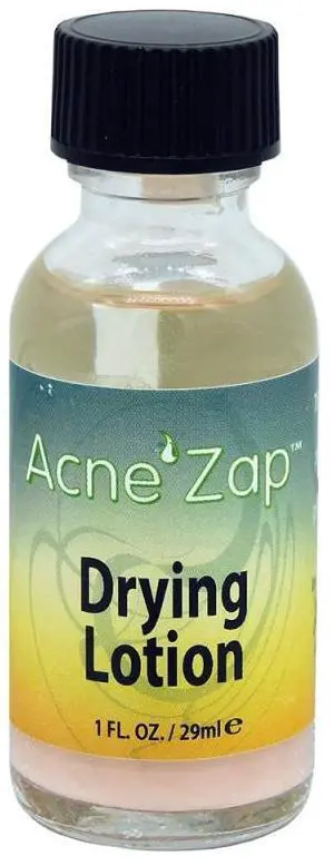 Ovante Acne Spot Treatment - Powerful Drying Lotion for Targeting Acne, Pimples, Blemishes, and Skin Imperfections, Helps Clear Breakouts and Promotes Clearer, Healthier Skin - 1.0 Fl Oz