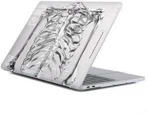 Case Compatible with MacBook Air 13 Inch 2022-2018 Release Model A2337 M1 M2 A2681, Art Protector Cover for Air13 Retina Display with Touch ID-Human Skeleton,13.3 Air(A1932/A2179/A2337)