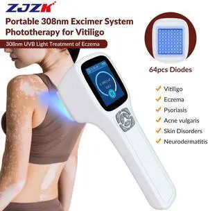 ZJZK 308nm wavelength UVB portable handheld Lamp device, suitable for home use, safe and efficient for vitiligo psoriasis