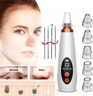 3 Speeds Electric Blackhead Remover Face Deep Pore Acne Skin Care Device Pimple Removal Vacuum Suction Facial Dirt Beauty Tool