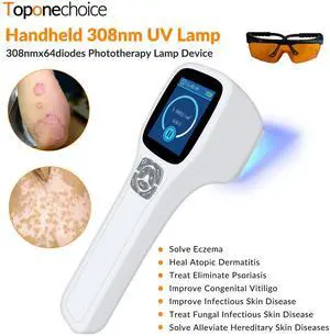 Toponechoice 308nm Excimer Light High-intensity Ultraviolet Light for Skin Treatment 0-5J/cm2