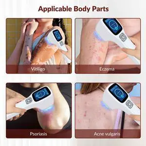 Toponechoice at home uv light for psoriasis, home remedies for vitiligo on hands, white spots on newborn nose