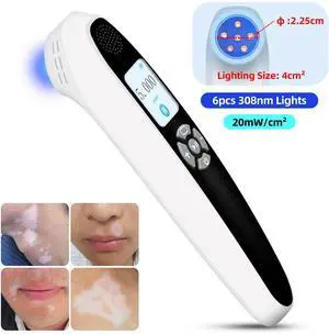 Toponechoice lichen planus ultraviolet light therapy home remedies for vitiligo lips, milia face, white marks in throat