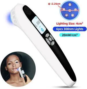 Toponechoice at home uv light good from sun for psoriasis, vitiligo on hands, white spot under fingernail