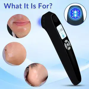 Toponechoice uv light therapy home for dermatitis, little white dots on lips, white dots on newborn nose