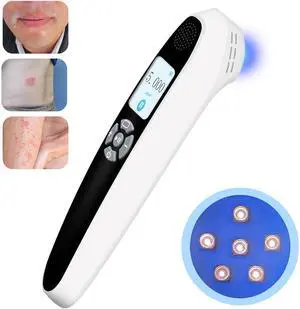 Toponechoice dermatologist uv treatment for vitiligo white discoloration on nails, white patches at back of throat