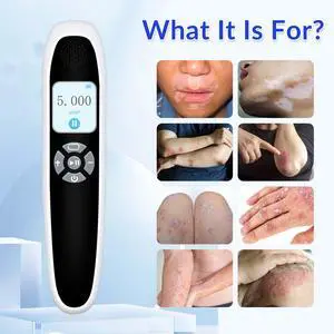 Toponechoice dermatologist uv treatment for vitiligo lips tiny white dots on lips fingernail milia face