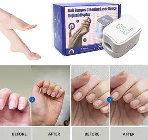 Toponechoice Liquid Crystal Nail Fungus Phototherapy Device Smart Ultraviolet Fungal Phototherapy Lamp Portable Sterilising Phototherapy Instrument Toponechoice Liquid Crystal Nail Fungus Phototherapy Device Smart Ultraviolet Fungal Phototherapy Lamp Portable Sterilising Phototherapy Instrument