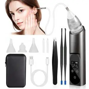 Ear Wax Vacuum Removal Kit with Carrying Case, 6 Levels Electric Strong Suction Ear Wax Remover, USB Charge Ear Wax Vacuum Cleaner, Ear Wax Suction Remover Device for Adults and Kids (Black) Ear Wax Vacuum Removal Kit with Carrying Case, 6 Levels Electric Strong Suction Ear Wax Remover, USB Charge Ear Wax Vacuum Cleaner, Ear Wax Suction Remover Device for Adults and Kids (Black)