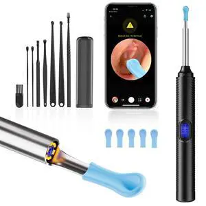 AI Eardrum Alert, AI Ear Wax Removal Kit, 1080P HD Camera with 6-Axis Gyroscope, Waterproof Lens, 230mAh Battery, Earwax Removal Tool with 8 Pcs Ear Set, Otoscope Camera for iOS & Android (Black) AI Eardrum Alert, AI Ear Wax Removal Kit, 1080P HD Camera with 6-Axis Gyroscope, Waterproof Lens, 230mAh Battery, Earwax Removal Tool with 8 Pcs Ear Set, Otoscope Camera for iOS & Android (Black)