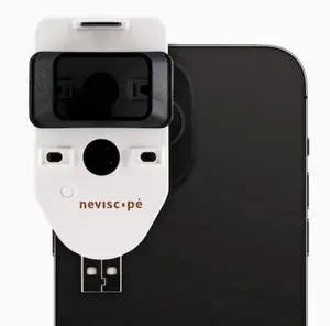 Neviscope Black Phone Dermatoscope Microscope with Polarized Lens/LED Light, 100x Camera Attachment with Universal Clip for Most iPhone/Android Phones Free App Neviscope Black Phone Dermatoscope Microscope with Polarized Lens/LED Light, 100x Camera Attachment with Universal Clip for Most iPhone/Android Phones Free App