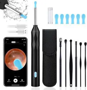 Ear Wax Removal Cleaner with Camera: Favofit Earwax Otoscope with Lights - Endoscope Ear Wax Remover Cleaning for iOS Android Ear Wax Removal Cleaner with Camera: Favofit Earwax Otoscope with Lights - Endoscope Ear Wax Remover Cleaning for iOS Android