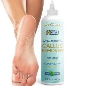 Feet (Extra Strength) Foot Callus Remover Gel - Pedicure Tools for Feet Scrubber Foot Care Spa Essentials, 6oz Feet (Extra Strength) Foot Callus Remover Gel - Pedicure Tools for Feet Scrubber Foot Care Spa Essentials, 6oz