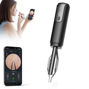 Blackhead Removal Tweezer with 1080p Camera, Ultimate Precision: Blackhead Removal with Camera - Perfect for Delicate Tasks! - - Ingrown Hair, Ear Hair Tweezer (Black) Blackhead Removal Tweezer with 1080p Camera, Ultimate Precision: Blackhead Removal with Camera - Perfect for Delicate Tasks! - - Ingrown Hair, Ear Hair Tweezer (Black)