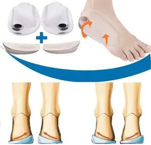 Orthopedic Insoles for Correcting O/X Type Leg Shoe Inserts, Built in Magnetic Heel Shoe Cushions for Foot Alignment, Knock Knee Pain, Bow Legs- 2 Pairs Orthopedic Insoles for Correcting O/X Type Leg Shoe Inserts, Built in Magnetic Heel Shoe Cushions for Foot Alignment, Knock Knee Pain, Bow Legs- 2 Pairs