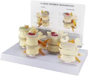 4-Stage Vertebrae ModelSpine Model | Human Body and Anatomy Replica for Physiology Education, Anatomical Model for Doctor's Office, Medical Learning Resources 4-Stage Vertebrae ModelSpine Model | Human Body and Anatomy Replica for Physiology Education, Anatomical Model for Doctor's Office, Medical Learning Resources