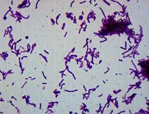 25pk Bacillus Smear, Gram Negative Stain - Prepared Microscope Slides - 75 x 25mm - Classroom Pack, 25 Slides in Storage Case - Biology & Microscopy - Labs 25pk Bacillus Smear, Gram Negative Stain - Prepared Microscope Slides - 75 x 25mm - Classroom Pack, 25 Slides in Storage Case - Biology & Microscopy - Labs