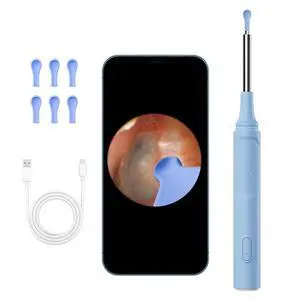 Ear Wax Removal Tool with Camera, 800W HD 360° Otoscope, 3.5mm Thin Lens 6 LED Lights, Waterproor Kids Adults Pets (Blue) Ear Wax Removal Tool with Camera, 800W HD 360° Otoscope, 3.5mm Thin Lens 6 LED Lights, Waterproor Kids Adults Pets (Blue)