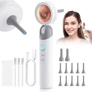 1080P HD Otoscope Ear Camera for Family, Medical Grade 1.38" Screen, Telemedicine Ready, 12 Silicone Tips and 3 Adhesive Ear Sticks, Photo/Video, Type-C Charging, Home Medical 1080P HD Otoscope Ear Camera for Family, Medical Grade 1.38" Screen, Telemedicine Ready, 12 Silicone Tips and 3 Adhesive Ear Sticks, Photo/Video, Type-C Charging, Home Medical