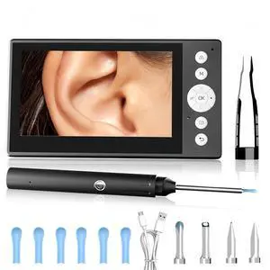 Ear Wax Removal Tool Wireless Otoscope with 4.3" IPS Screen Earscope Camera Ear Wax Removal Tool Wireless Otoscope with 4.3" IPS Screen Earscope Camera