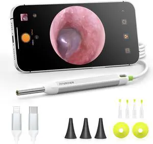 Otoscope with Gyroscope, Ear Scope Camera, Compatible with iPhone/Android Otoscope with Gyroscope, Ear Scope Camera, Compatible with iPhone/Android