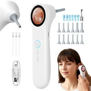 Otoscope Ear Camera with Light, Ear Wax Removal Camera for Adults Kids Otoscope Ear Camera with Light, Ear Wax Removal Camera for Adults Kids