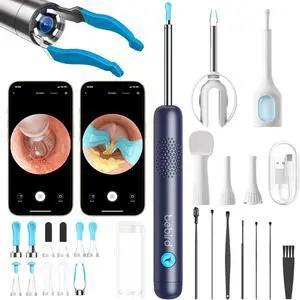 R1 Ultra Ear Wax Removal Tweezers: 1296P HD Ear Camera Cleaner, Blue R1 Ultra Ear Wax Removal Tweezers: 1296P HD Ear Camera Cleaner, Blue