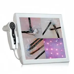 Professional 15-Inch Scalp Camera for Beauty Salons High-Resolution Hair and Scalp Analysis Device with Image Storage, Easy Assembly, Durable Build, Ideal for Client Consultations & Head Spa Professional 15-Inch Scalp Camera for Beauty Salons High-Resolution Hair and Scalp Analysis Device with Image Storage, Easy Assembly, Durable Build, Ideal for Client Consultations & Head Spa