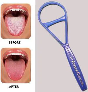 The Tongue Cleaner The Tongue Cleaner