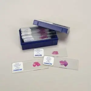 Malignant Tissues Microscope Slide Set Malignant Tissues Microscope Slide Set