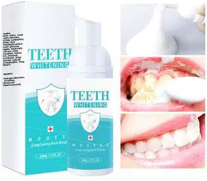 Teeth Whitening Mousse - Refreshing Breath Deep Cleaning Foam Toothpaste Natural Mouth Wash Water, Ultra Fine Mousse Foam To Reduce Stains Teeth Whitening Mousse - Refreshing Breath Deep Cleaning Foam Toothpaste Natural Mouth Wash Water, Ultra Fine Mousse Foam To Reduce Stains