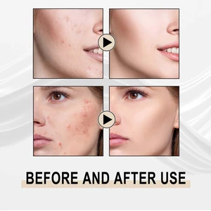 Exfoliation & Hydration, Blackhead Removal, Pore Minimization, Lactobionic Acid Essence for Deep Cleansing Exfoliation & Hydration, Blackhead Removal, Pore Minimization, Lactobionic Acid Essence for Deep Cleansing