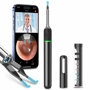 Ear Wax Removal Tool with Real-time Remote Video, 3-in-1 Ear Cleaner Earwax Removal Kit with Ear Pick & Tweezers Mode, 10MP Ear Camera Otoscope with Light, 12 Pcs Ear Scoops for Whole Family Ear Wax Removal Tool with Real-time Remote Video, 3-in-1 Ear Cleaner Earwax Removal Kit with Ear Pick & Tweezers Mode, 10MP Ear Camera Otoscope with Light, 12 Pcs Ear Scoops for Whole Family