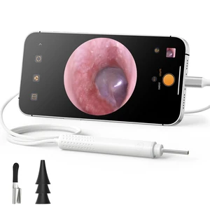 USB C Digital Otoscope with Light for iPhone 15/16/17 Android | 3.9mm Lens, 720P Ear Camera, Split-screen, 6 LED Lights, No WiFi Needed, Photo & Video, Plug & Play for Safe Home Ear Check USB C Digital Otoscope with Light for iPhone 15/16/17 Android | 3.9mm Lens, 720P Ear Camera, Split-screen, 6 LED Lights, No WiFi Needed, Photo & Video, Plug & Play for Safe Home Ear Check