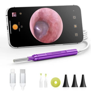Digital Otoscope Compatible with iPhone & Android, Video Ear Scope Camera | Otoscope with Light, 3.9mm Lens, Plug & Play, Photo & Video, Split-screen, Earwax Removal Kit for Home Cleaning Checking Digital Otoscope Compatible with iPhone & Android, Video Ear Scope Camera | Otoscope with Light, 3.9mm Lens, Plug & Play, Photo & Video, Split-screen, Earwax Removal Kit for Home Cleaning Checking